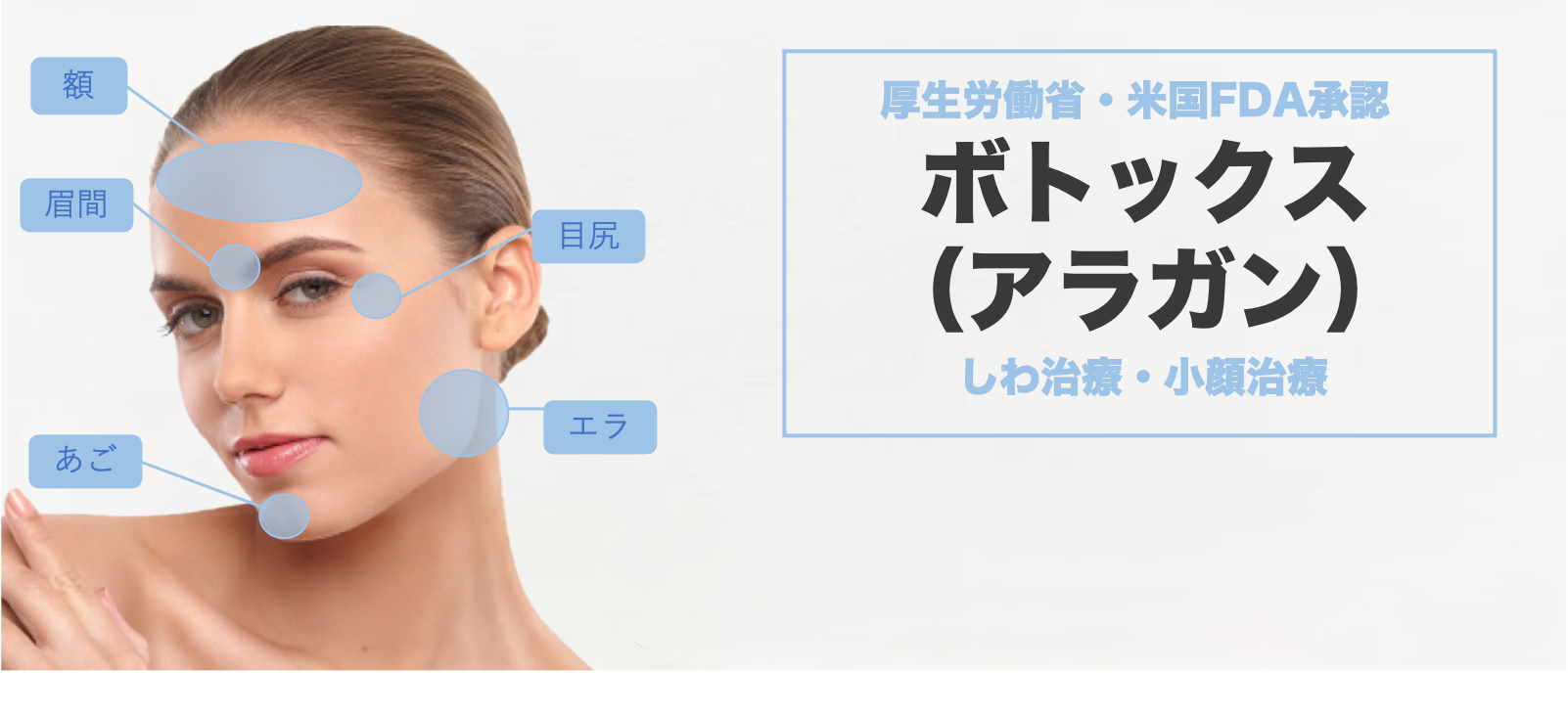 ボトックス(アラガン)
